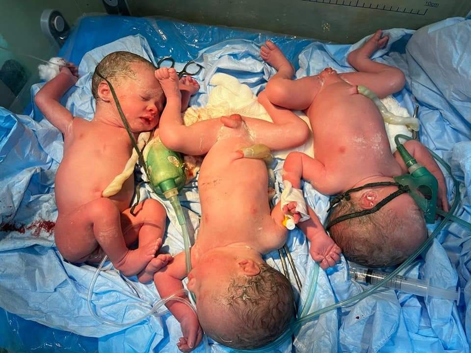 ولادة توأم ثلاثي في محافظة عراقية (صورة)